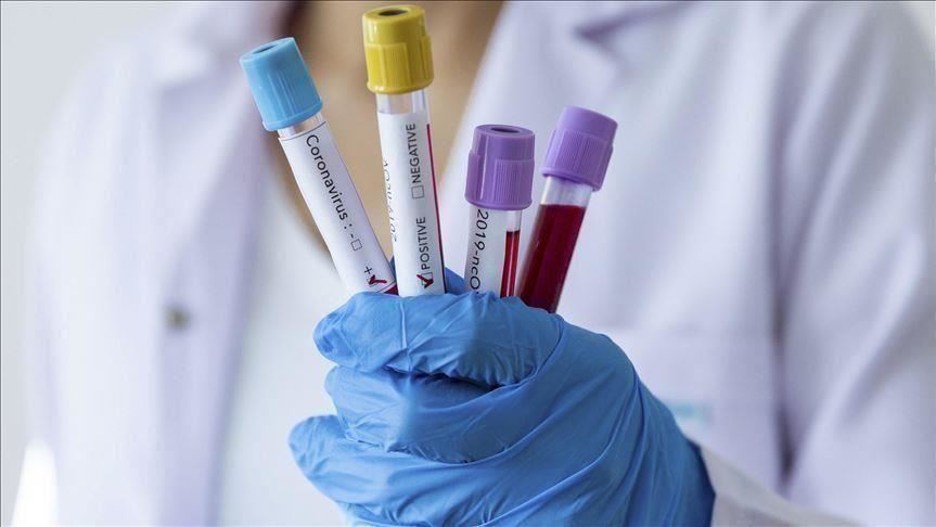 koronavirus-test-1