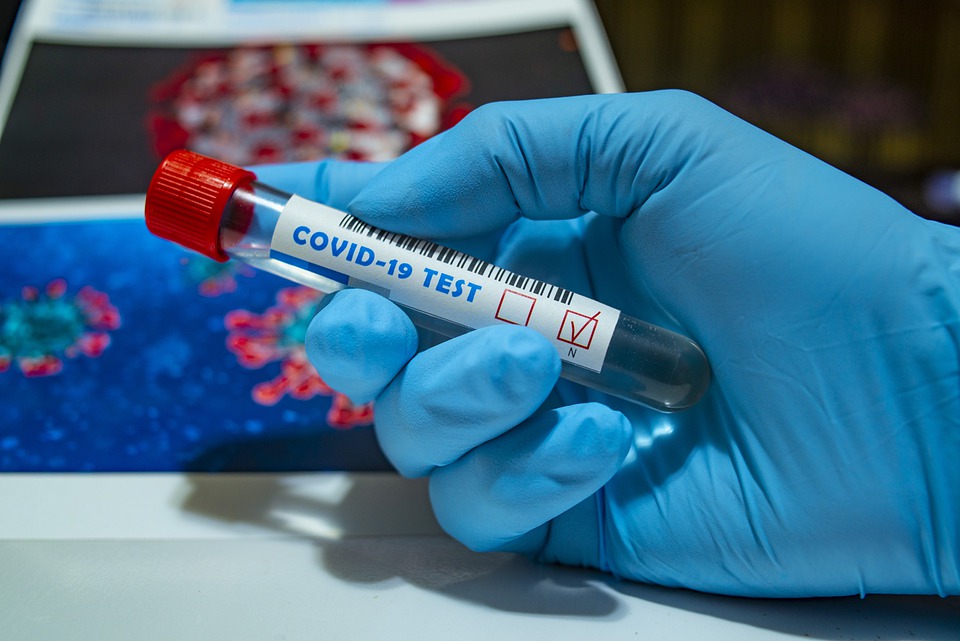 783459-vo-strumica-25-aktivni-sluchai-na-koronavirus