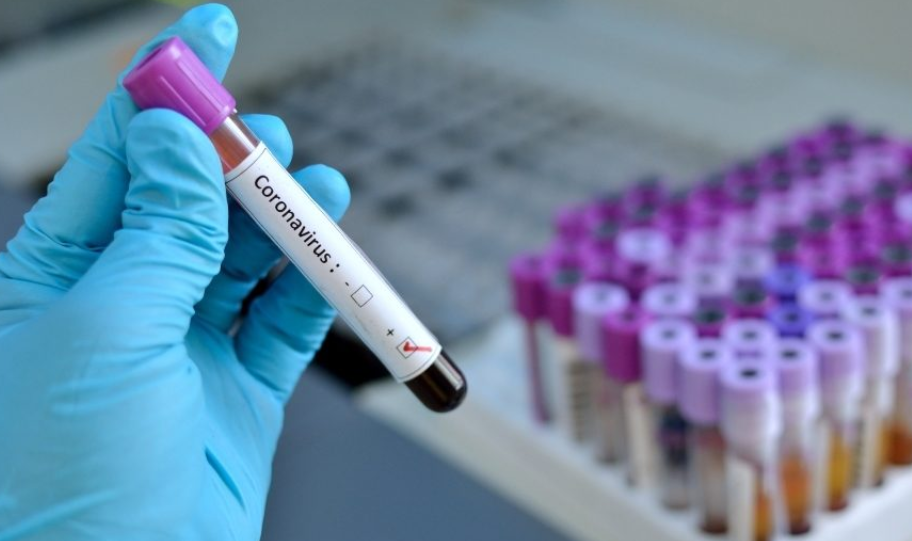 787202-145-zarazeni-i-2-pochinati-od-koronavirus-izminatite-24-chasa
