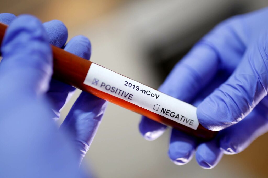 2020-03-06t181110z_1542383548_rc2ief9w7zkm_rtrmadp_3_health-coronavirus-telehealth