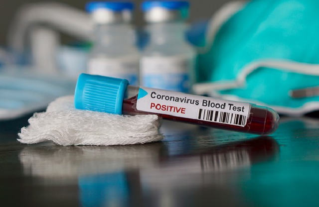 810180-utre-pristignuvaat-brzite-testovi-vo-shtip-od-sreda-se-pochnuva-so-testirane