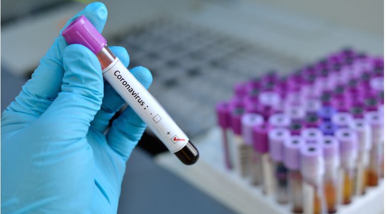815413-1342-zarazeni-i-22-pochinati-od-koronavirus-izminatite-24-chasa